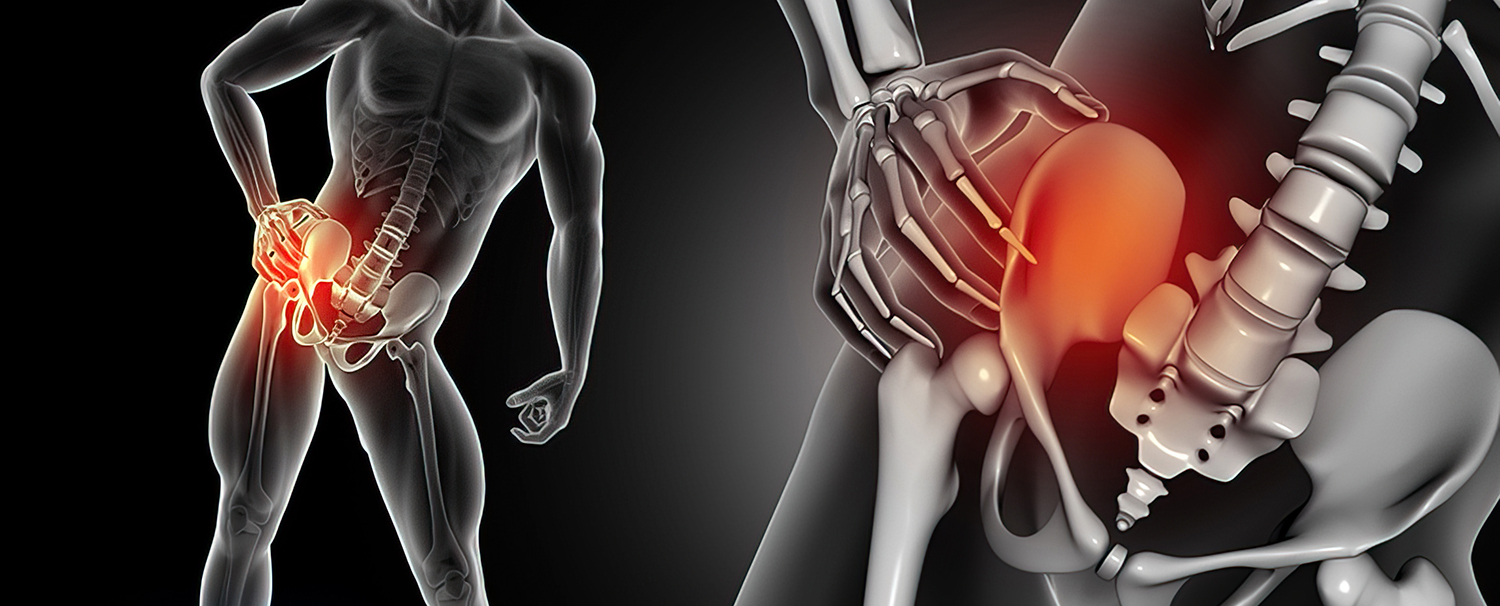Dr-Dutton-Hip-Bone-Pain-Illusration-gigapixel-low_res-scale-6_00x Medical illustration of hip and pelvic bone pain