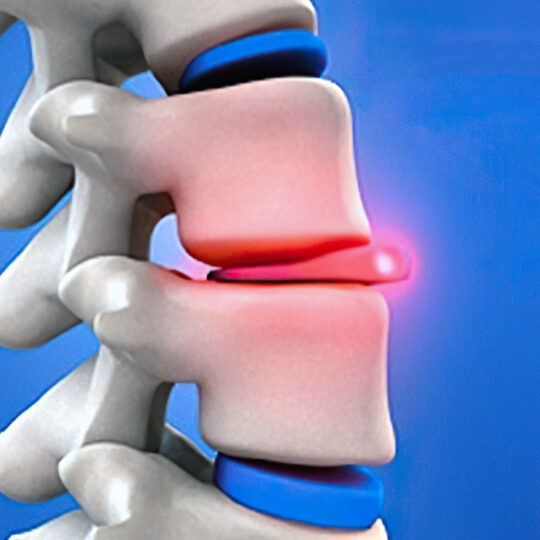 Common Conditions - TriMed Spine & Joint