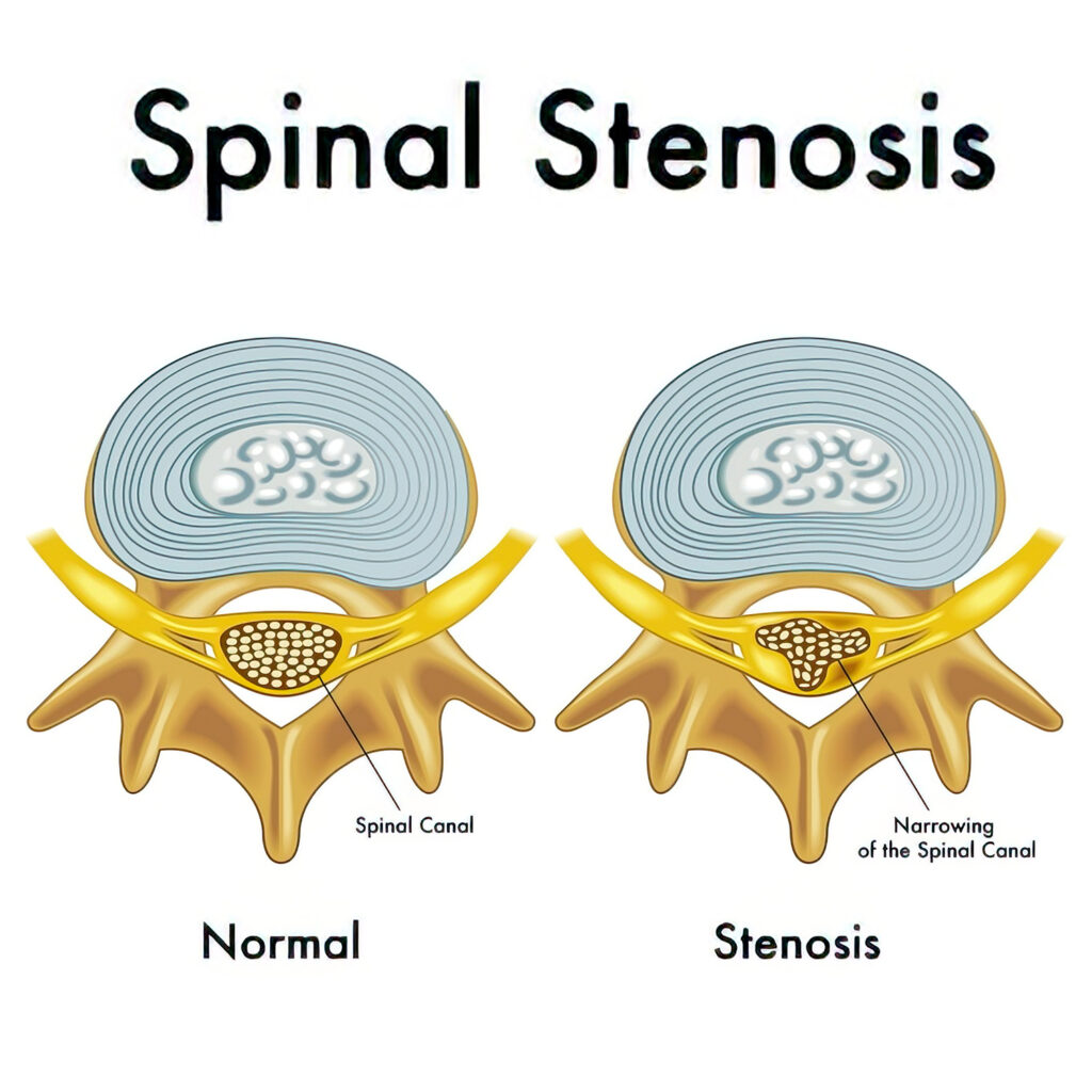 Common Conditions | TriMed Spine & Joint