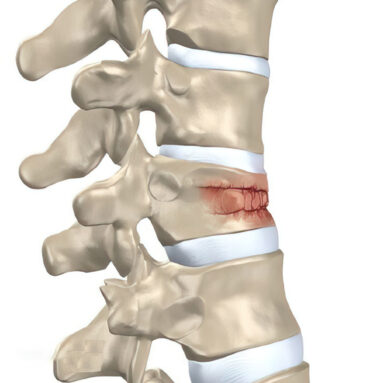 Common Conditions - TriMed Spine & Joint