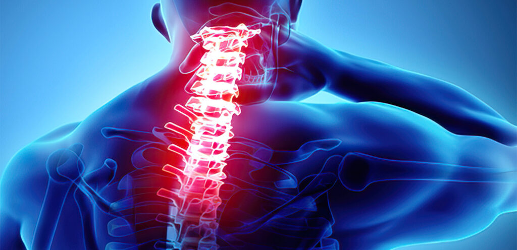 Neck Pain TriMed Spine Joint