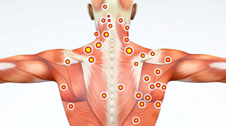 Trigger Point Injections TriMed Spine Joint