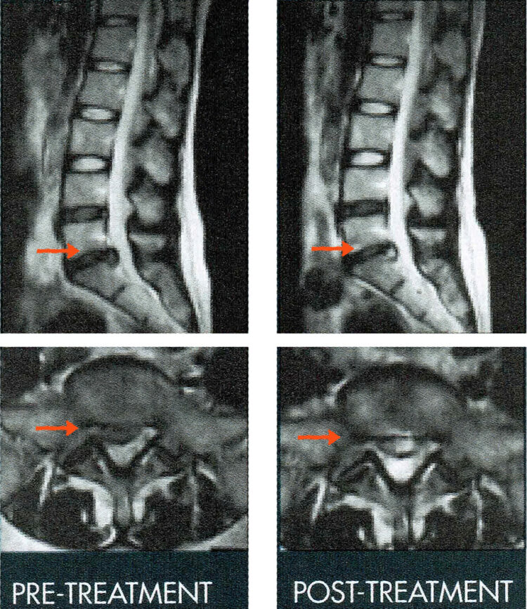 DRX 9000 Spinal Decompression - TriMed Spine & Joint